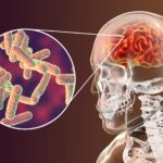 Meningite acende alerta em Goiás com 2 mortes e 16 casos confirmados em 2026