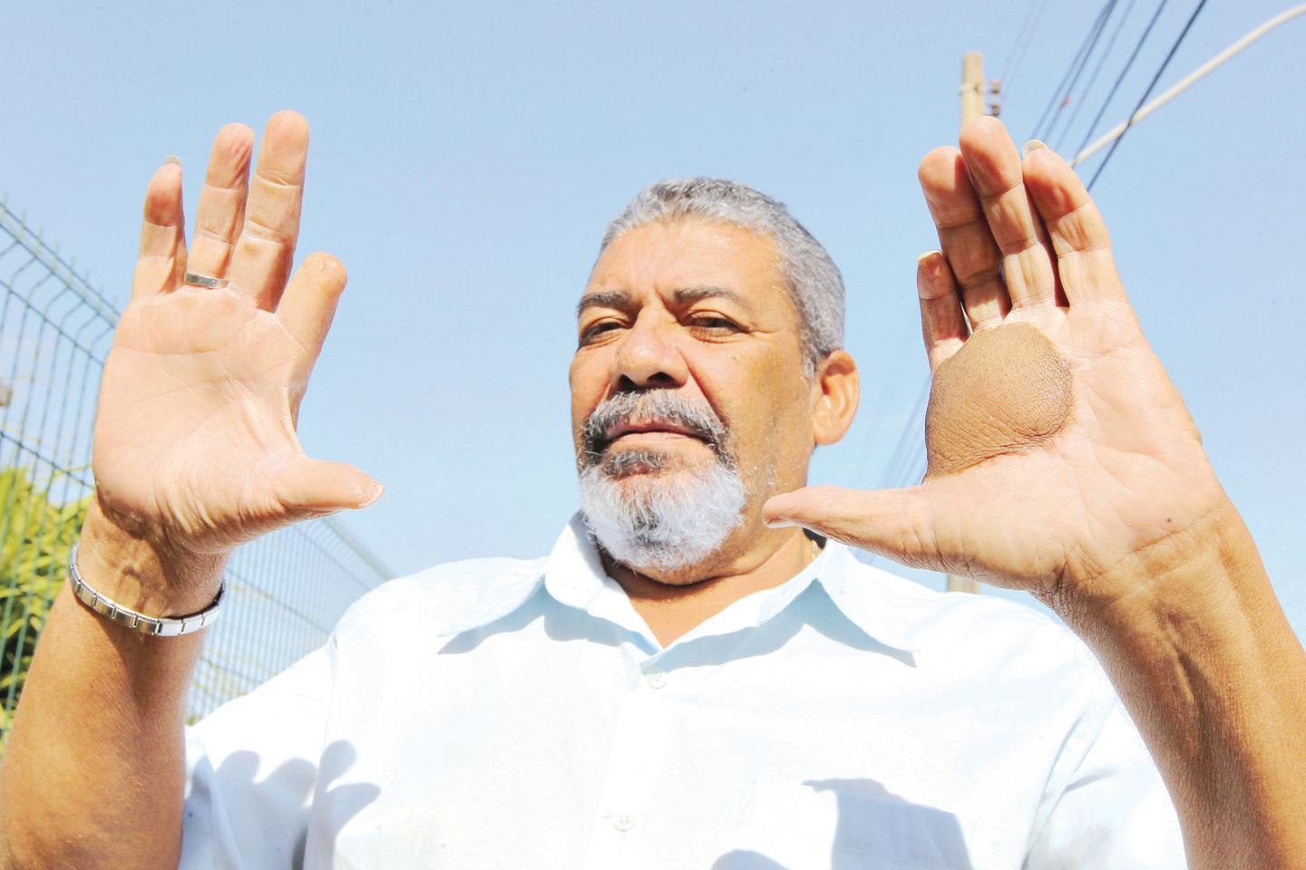 Goiás aprova aumento nas pensões para vítimas do acidente com Césio-137, com valores que chegam a R$ 3.242 após anos sem reajuste e repercussão da série Emergência Radioativa.