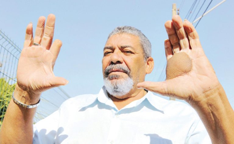 Goiás aprova aumento nas pensões para vítimas do acidente com Césio-137, com valores que chegam a R$ 3.242 após anos sem reajuste e repercussão da série Emergência Radioativa.